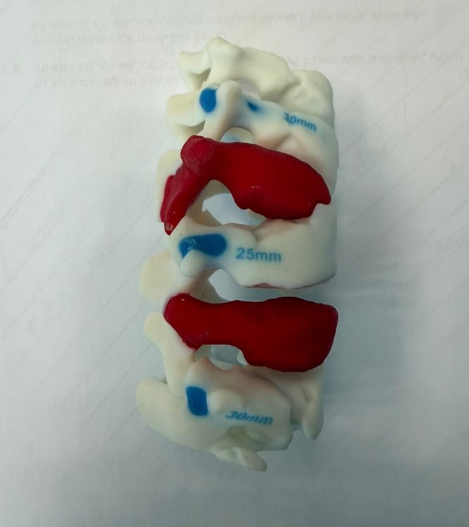 הדפסת תלת מימד