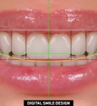 רנטגן - תמונת המחשה