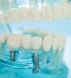 רמת DHEAS גבוהה - תמונת אווירה