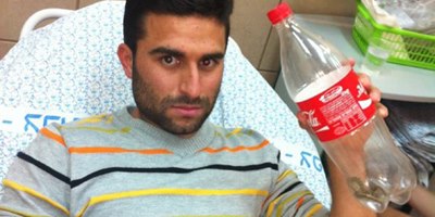 נחש (צילום: דוברות בית חולים זיו)