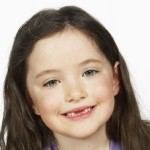 טיפול ותחזוקה של שיניים בילדים-תמונה