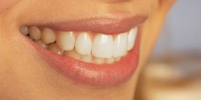 אסתטיקה דנטלית - תתחילו לחייך-תמונה