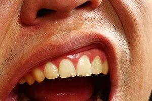 חלל הפה: התייחסות לכאבים-תמונה