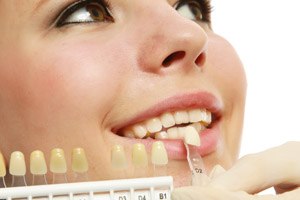 הלבנת שיניים: לבן הכי יפה-תמונה
