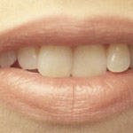 נותנים אגוזים למי שיש שיניים-תמונה