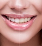 קצר ולעניין: כך תשיגו חיוך לבן וזוהר בקלות-תמונה