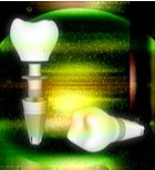 ד"ר רז חנן: "השתלת שיניים דיגיטלית היא הפתרון לכל מי שחרד מטיפולי שיניים"-תמונה