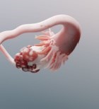 כריתת שחלות - תמונת אווירה