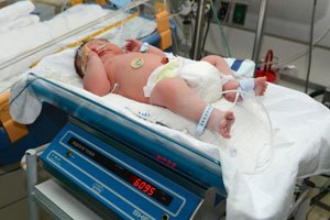 התינוק בפגייה ברמב'ם. צילום: עופר גולן  