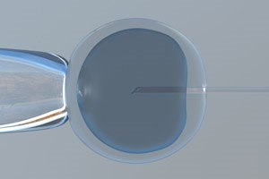 נדחתה תביעה בגין הולדה בעוולה-תמונה