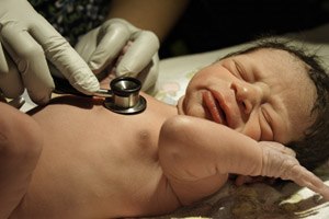 לידת בית ומדד אפגר נמוך (אילוסטרציה)