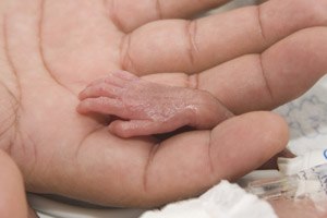 סיפור אישי: הורות לתינוק פג