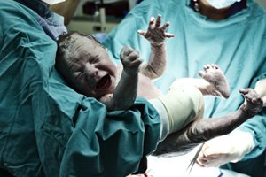 הכנות ללידה (אילוסטרציה)