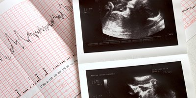 שיעור טיפולי הפוריות זינק ב-120%-תמונה