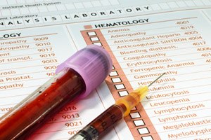 בדיקת דם במקום מי שפיר?-תמונה