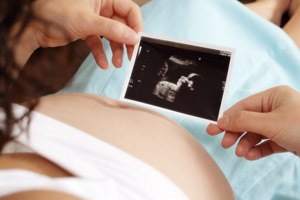 MRI עובר - תמונת אווירה