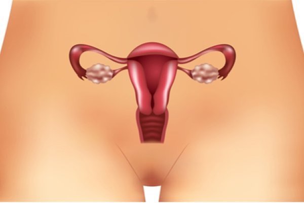 שחלות פוליציסטיות: כיצד לטפל?-תמונה