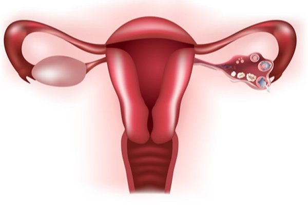 מעקב זקיקים: האם את זקוקה?-תמונה
