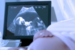 הרחבת אגן כליה: מה לעשות?-תמונה