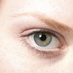 דלקת בשולי העפעפיים-תמונה