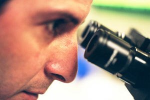 עיניים: אסטיגמציה והטיפול בה-תמונה