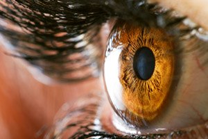 ניתוח לייזר: שיפור במהירות האור-תמונה