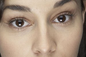 עיניים: איך מטפלים בעיגולים שחורים?-תמונה