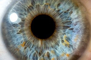 קרוסלינקינג: טיפול חדשני בקרטוקונוס-תמונה