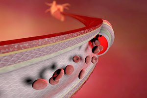 בדיקת דופלר: סיור בכלי הדם-תמונה