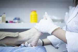 דורבן בעקב - תמונת אווירה