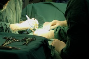 קרוהן וקוליטיס: ניתוח זעיר פולשני-תמונה