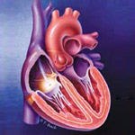 סליחה, מה רמת ההומוציסטאין שלך?-תמונה