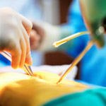 קדימה צעד-תמונה