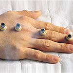 אירוע מוחי בראי הרפואה המשלימה-תמונה