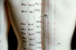 כאב בערמונית? תדקרו אותה-תמונה