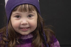 האם כדאי להסיר "שקד שלישי"?-תמונה