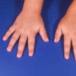 תרגולת קרב-תמונה