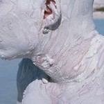 מלנומות - גילוי סקירה ומעקב-תמונה