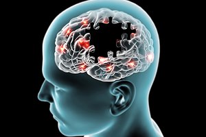 בדיקה פשוטה תזהה אלצהיימר? (אילוסטרציה shutterstock)