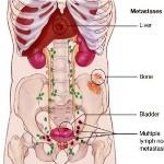 ורדנפיל - תמונת אווירה