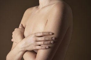 טיפולי IVF - סיכון לסרטן השד-תמונה