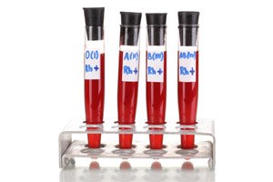 בדיקת מח עצם - תמונת אווירה