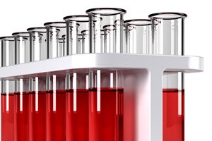 בדיקת דם לגילוי גן סרטן השד-תמונה