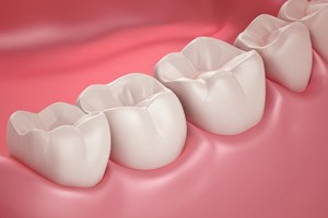 סרטן חלל הפה (אילסוטרציה)