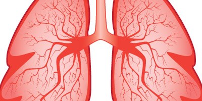 סרטן ריאה: טיפול חדש-תמונה
