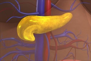 ניתוח לבלב - תמונת אווירה