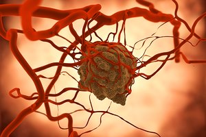 הפרשת יתר של אינסולין - תמונת המחשה