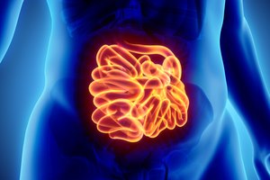 גידול במעי הדק - תמונת אווירה