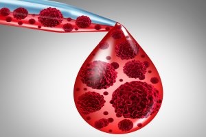 לנלידומיד - תמונת אווירה