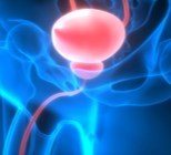 מהגורמים ועד לטיפול: כל מה שחשוב לדעת על סרטן שלפוחית השתן-תמונה